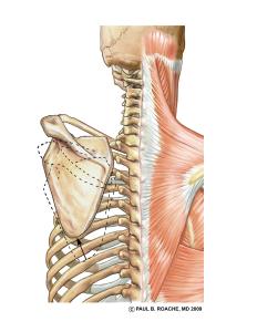 Elevate Scapula Color