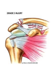 Grade 3 Injury Color