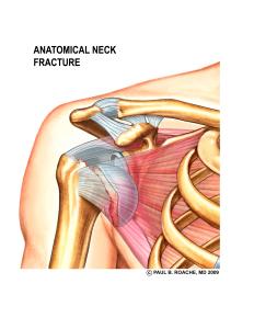 FX Anat Neck