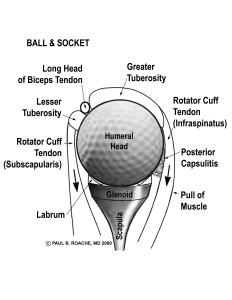 Post Capsulitis