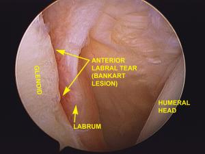 Arthro Bank