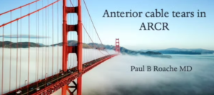 Anterior Cable tears basics
